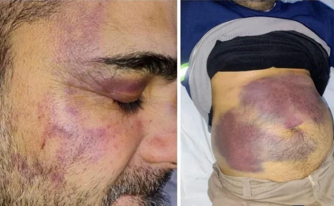 Torturas en Ulapes: 8 policías detenidos en La Rioja